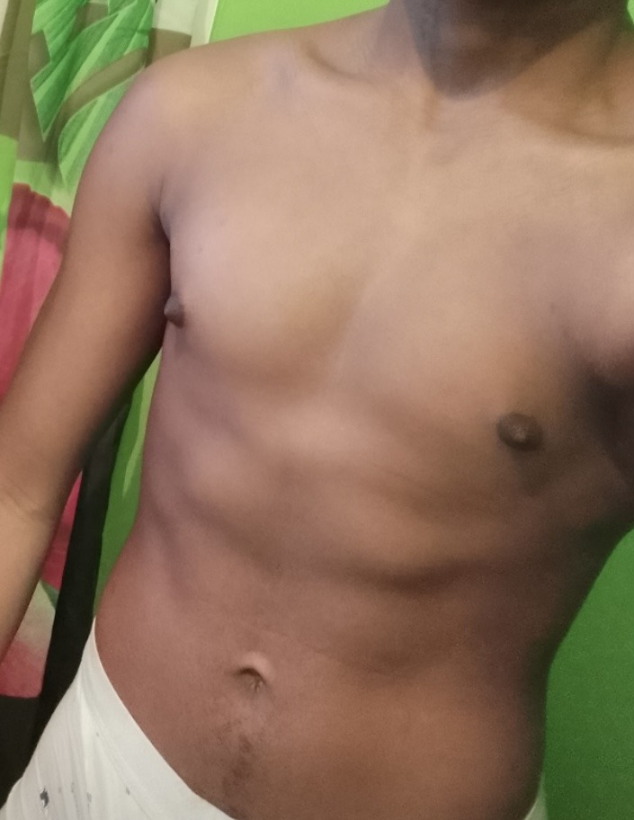 Arman - Oberbruck - Haut-Rhin | Plan cul